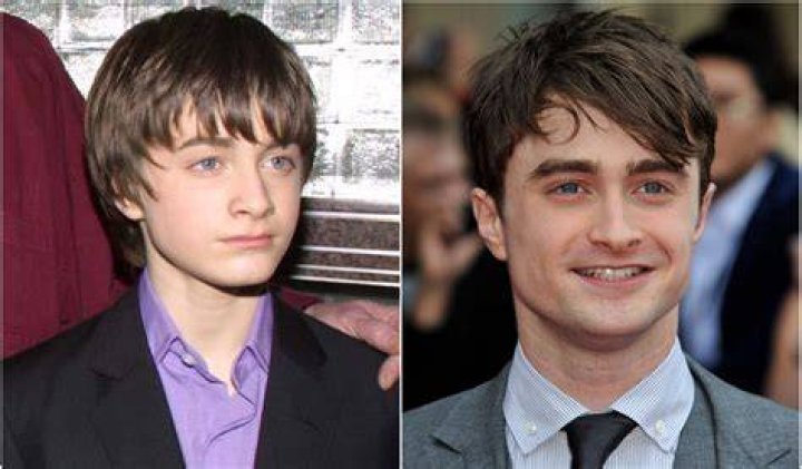 Daniel Radcliffe's Age: Then & Now